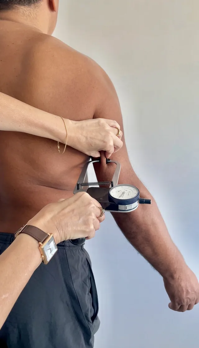 Medición de un pliegue graso con plicómetro